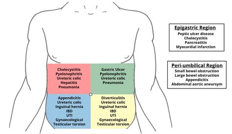 teachmesurgery|teach me surgery abdominal pain.